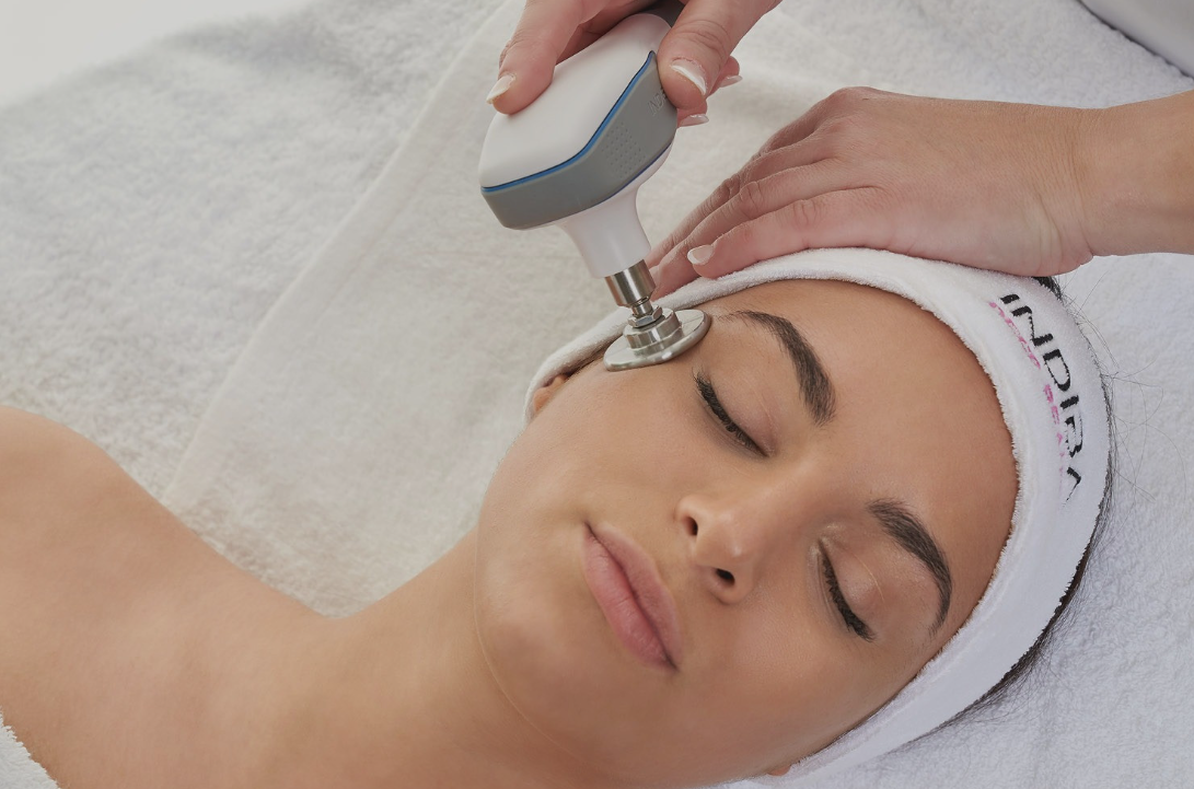 tratamiento facial con indiba